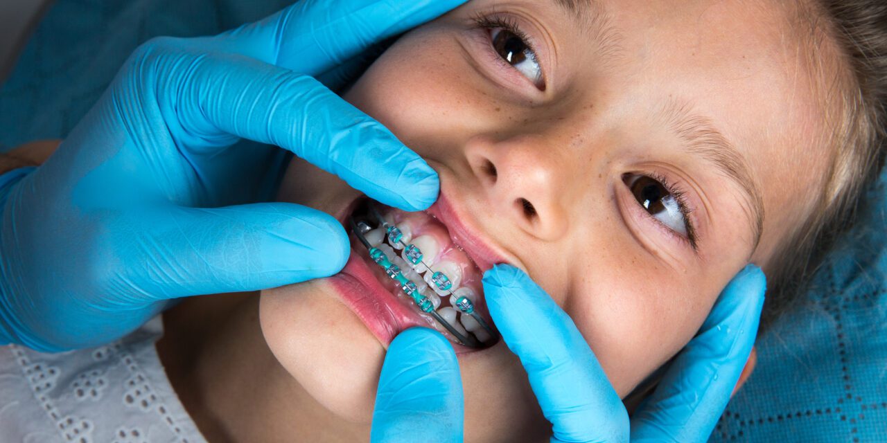 AAOF捐赠的正畸服务项目德赢vwinac登录获得ASAE奖