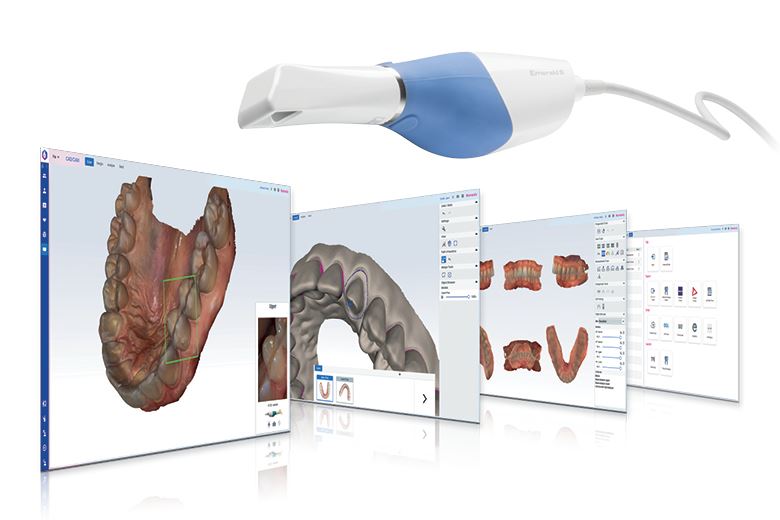 Planmeca发布Romexis CAD/CAM软件模块