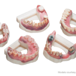 3Shape介绍Stratasys 3D打印机的自动化工作流程
