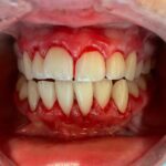 结合最新的牙科激光到正畸实践德赢vwinac登录